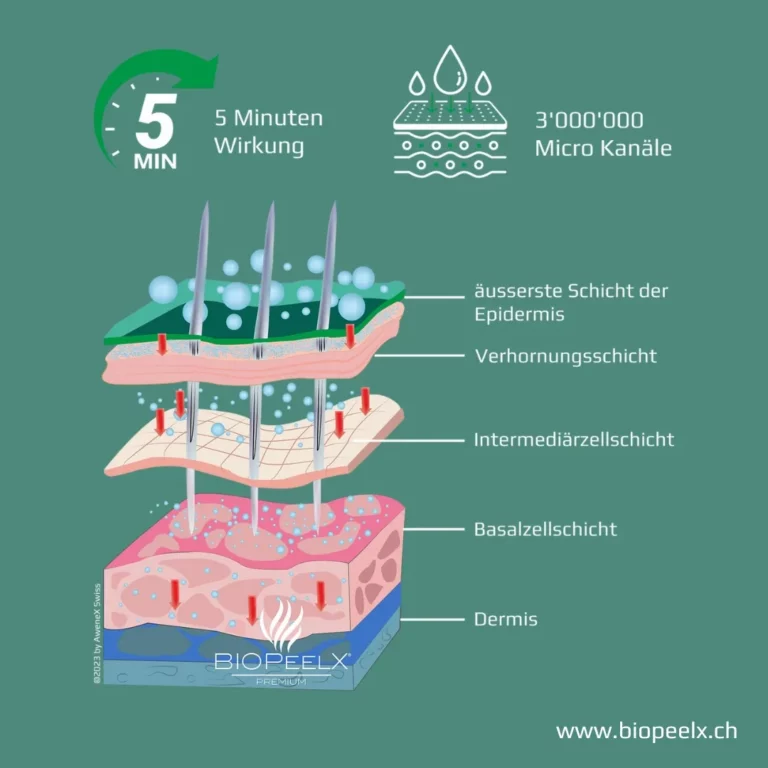 Die Schichten der Haut